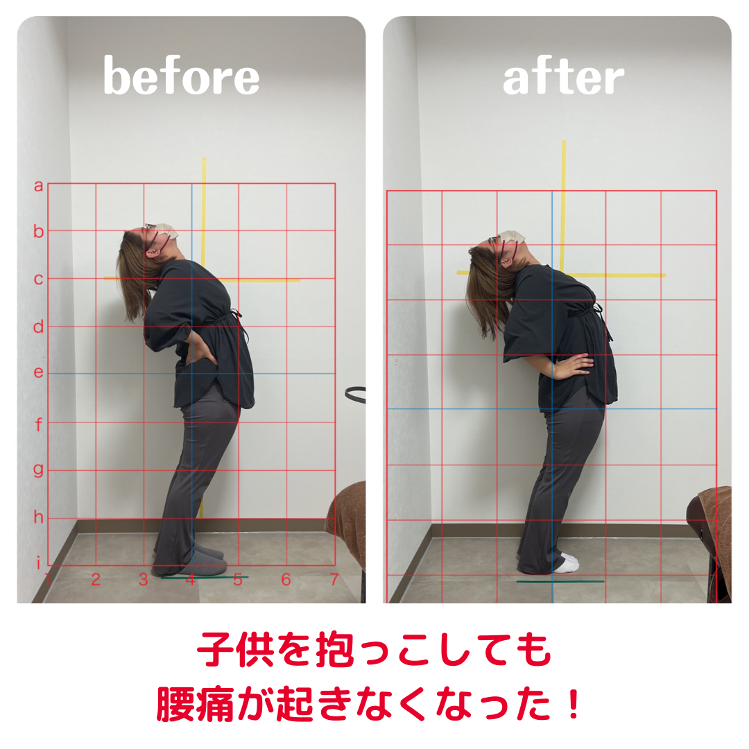 子供を抱っこしても腰痛が起きなくなった