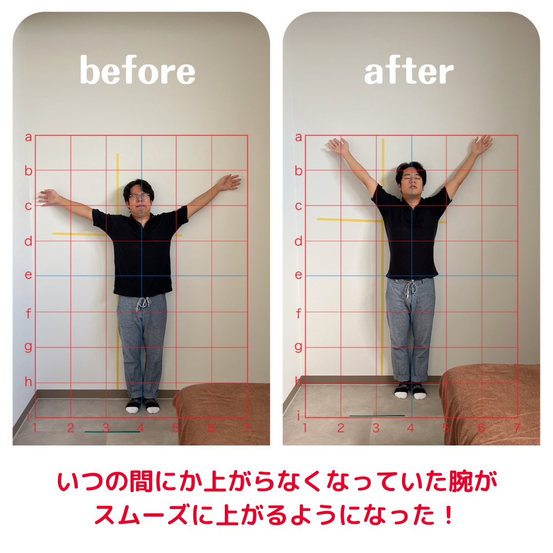 いつの間にか上がらなくなっていた腕がスムーズに上がるようになった