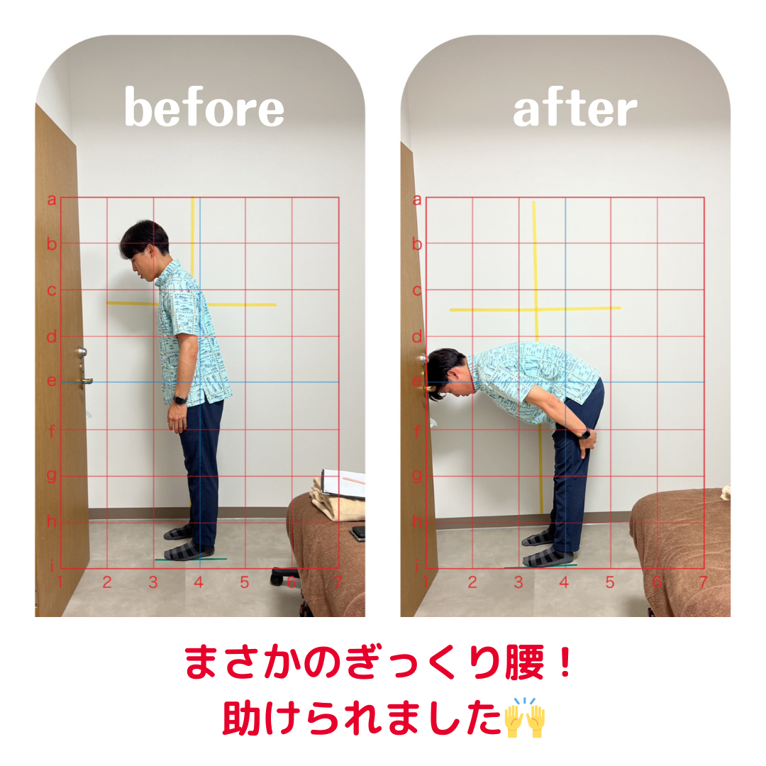 まさかのぎっくり腰!助けられました