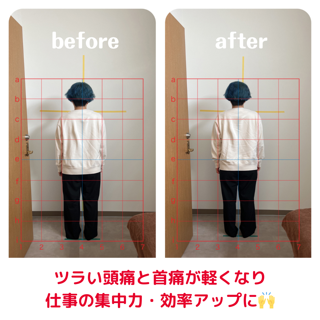 ツラい頭痛と首痛が軽くなり仕事の集中力・効率アップに