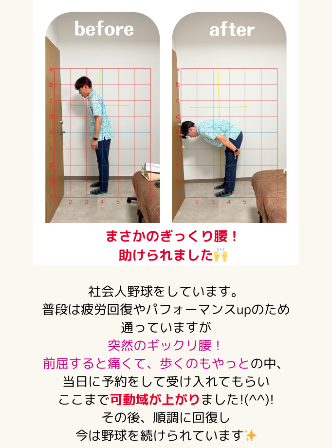 お客さまの声5:まさかのぎっくり腰！助けられました！