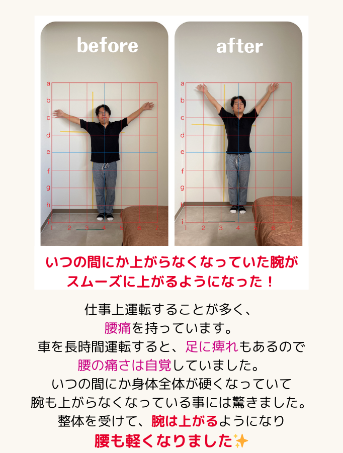 お客さまの声6:いつの間にか上がらなくなっていた腕がスムーズに上がるようになった！