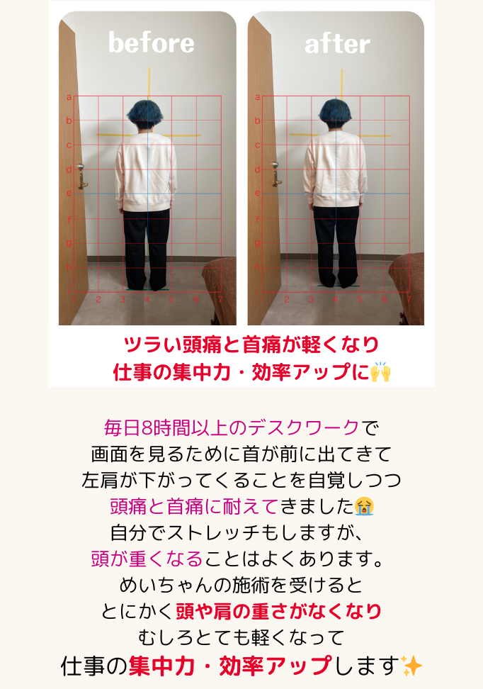 お客さまの声7:ツラい頭痛と首痛が軽くなり仕事の集中力・効率アップに！